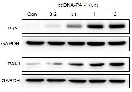 PAI-1의 과발현시스템에 의한 PAI-1확보