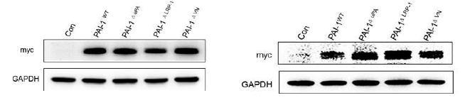 Site-directed Mutagenesis에 의해 mutated Macrophage-derived PAI-1와 wild type macrophage-derived PAI-1의 대식세포발현 (좌; RAW264.7, 우;U937)