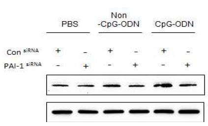 대식세포에서 CpG에 의해 발현 증가된 macrophage-derived PAI-1이 PAI siRNA에 의해 발현억제