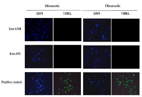 세포외기질 vitronectin과 fibronectin에서 exosomal ADAM15의 세포 사멸 효과