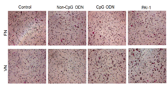 CpG에 의해 macrophage derived PAI-1이 발현증가된 대식세포와 PAI-1과발현된 대식세포의 vitronectin에 특이적인 세포이동 (세포염색)