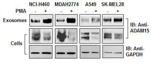 암세포종류들에서 세포내 또는 분비된 exosomal ADAM15의 발현 비교