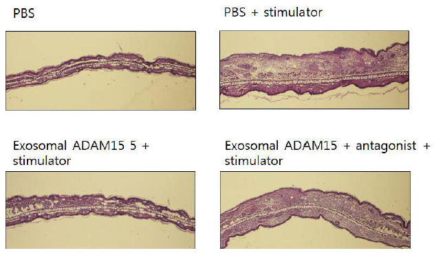 면역염증반응에서 부종을 일으킨 mouse ear에서 exosomal ADAM15의 활성 분석 및 antagonist에 의한 조절효과
