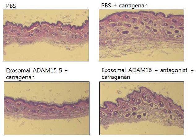 면역염증반응에서 부종을 일으킨 mouse foot에서 exosomal ADAM15의 활성 분석 및 antagonist에 의한 조절효과
