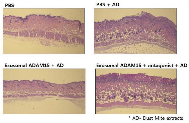 면역염증에 의한 아토피성 피부질환 유발에 의한 조직의 변화와 exosomal ADAM15의 활성분석 및 antagonist에 의한 조절효과