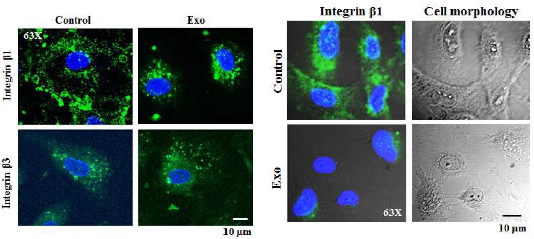 Exosomal ADAM 15에 의한 인테그린의 표면발현감소