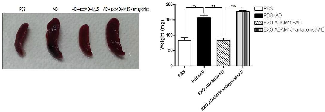 Exosomal ADAM 15에 의한 AD 마우스의 spleen 크기 비교