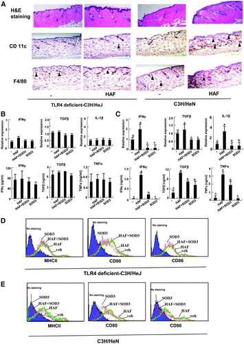 HAF에의해 유도되는 염증반응과 SOD3에 의한 억제작용은 TLR-4 signaling pathway를 통해 이루어짐.
