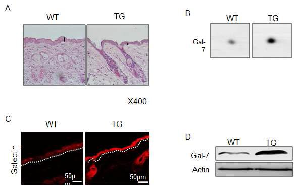 EC-SOD transgenic 생쥐는 얇은 표피와 증가된 galectic-7의 생성을 보임.