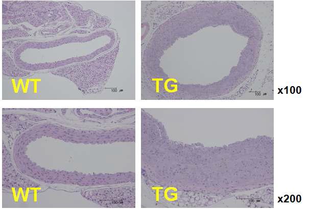 R213G TG의 동맥벽중간층이 증식하여 대동맥의 벽 두께가 두꺼워 짐.