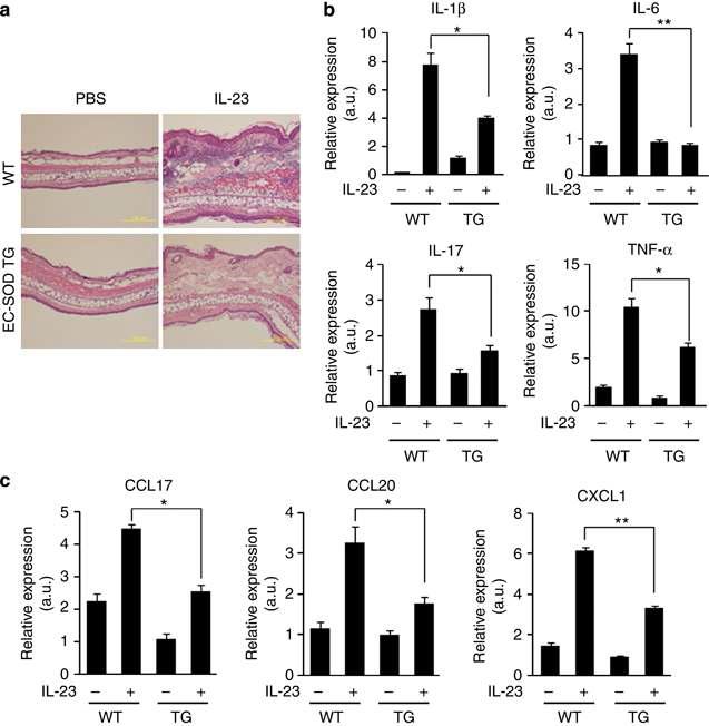 IL-23을 이용하여 건선유사 피부염을 유발할 시, EC-SOD TG 생쥐는 wild type 생쥐와 비교하여 피부조직 두께가 덜 두꺼워 졌으며, 건선유발 시 높게 발현되는 염증성 사이토카인과 키모카인의 발현도 억제되었음
