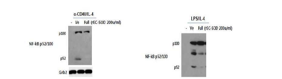 EC-SOD는 B세포에서 NF-kBp52의 발현을 억제함
