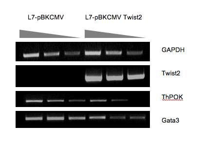 in vitro Twist2 모델 (그림 4 참조)에서 Twist2의 발현 및 Twist2가 조절하는 것으로 알려진 유전자의 발현을 확인한 결과.