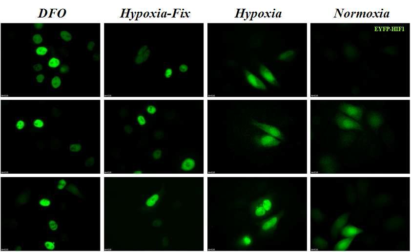 DFP 및 저산소 노출시 HeLa 세포에서의YFP-HIF-1alpah 단백질 발현 confocal imaging