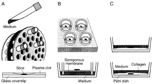 다양한 Organotypic slice 배양법 모식도