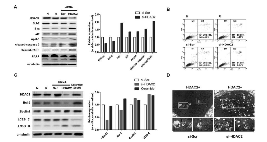 위암 세포주에서 HDAC2 유전자의 선택적 억제에 의한 세포 사멸 또는 자가포식적 세포사를 유도.