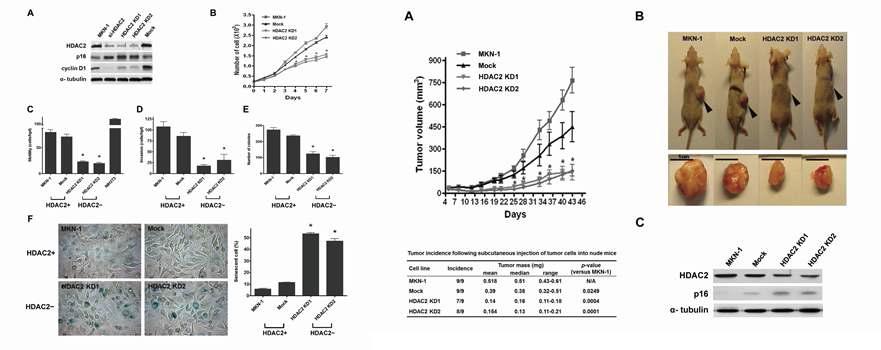 생체내에서 위암 세포주의 암화 과정에 HDAC2 결핍이 미치는 영향.