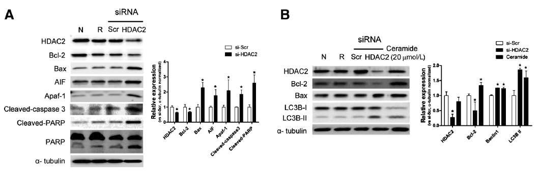 HDAC2 선택적 억제시 세포 사멸화 및 자가포식작용 유도