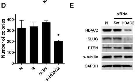 HDAC2 선택적 억제시 고정 비의존성 세포 성장 저해 및 SLUG 억제