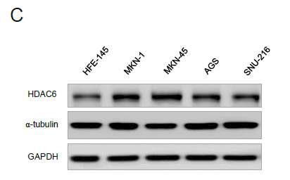 위암 세포주에서 HDAC6의 단백질 발현 양상