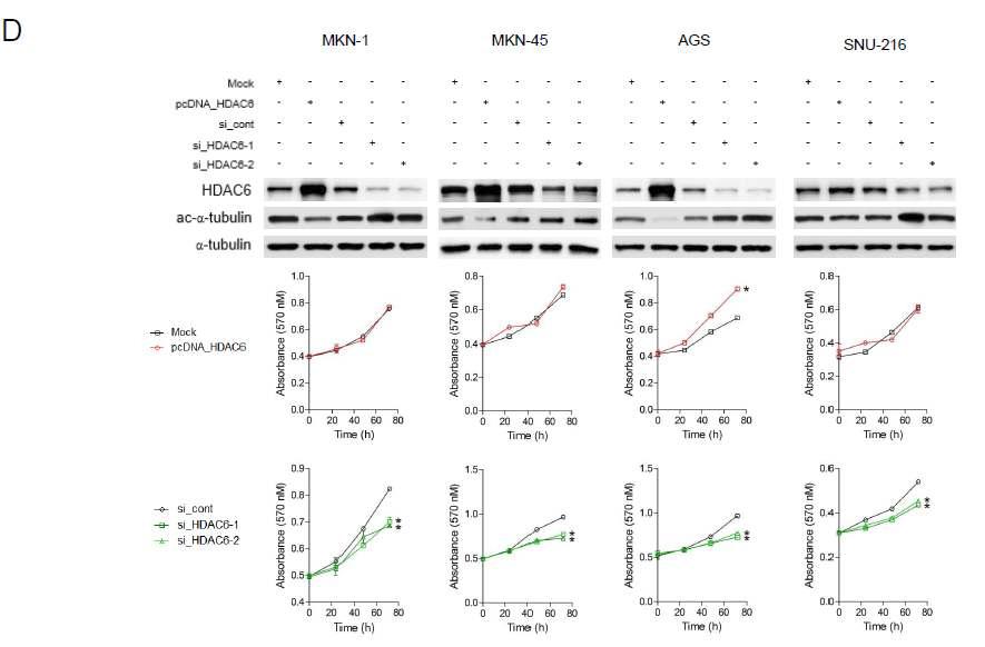 4가지 위암 세포주에서 HDAC6의 선택적 과발현 또는 억제시 세포 성장의 변화