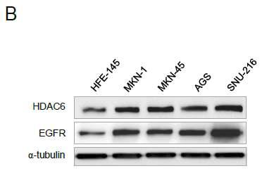 위암 세포주에서 HDAC6의 단백질 발현 양상