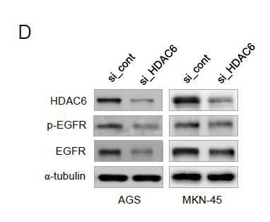 위암 세포주에서 HDAC6의 선택적 억제시 EGFR의 발현 양상