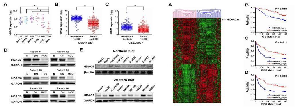 간암조직 및 세포주에서의 HDAC6의 발현 양상과 간암 환자들의 prognostic association