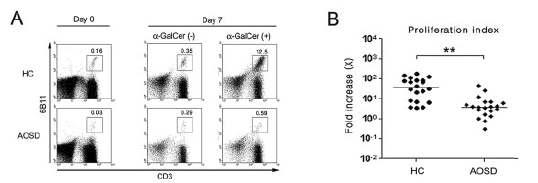 정상대조군과 자가면역질환(AOSD)질환군에서 α-GalCer에 대한 NKT 세포의 증식능력 평가