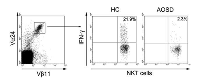 정상대조군과 자가면역질환(AOSD)질환군의 α-GalCer에 의한 NKT 세포내 Cytokine 분비능력 평가