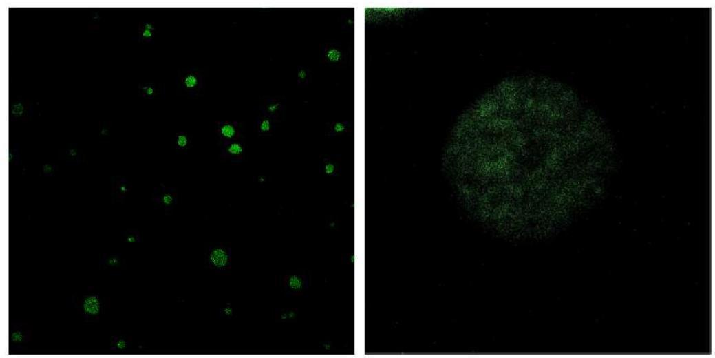 Fluorescein 접합 TRAIL 단백질이 봉입된 PLGA 다공성 마이크로입자 사진 (CLSM)