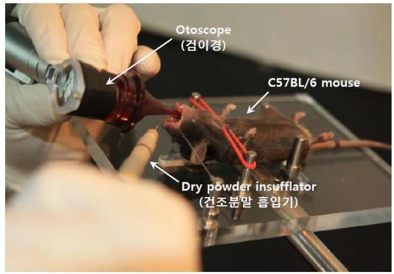 Dry powder insufflator와 검이경을 이용하여 독소루비신 봉입 다공성 마이크로입자를 C57BL/C 마우스의 기관지를 통해 폐투여하는 사진