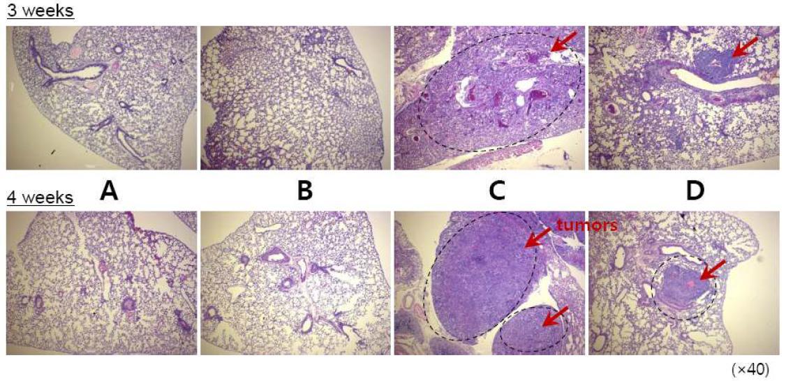 C57BL/C 마우스에서 B16F10 세포의 꼬리정맥을 통한 implantation과 독소루비신 봉입 다공성 마이크로입자의 C57BL/C 마우스의 기관지를 통해 폐투여 후 각 주에서의 폐조직 사진 (폐종양 조직 고찰)