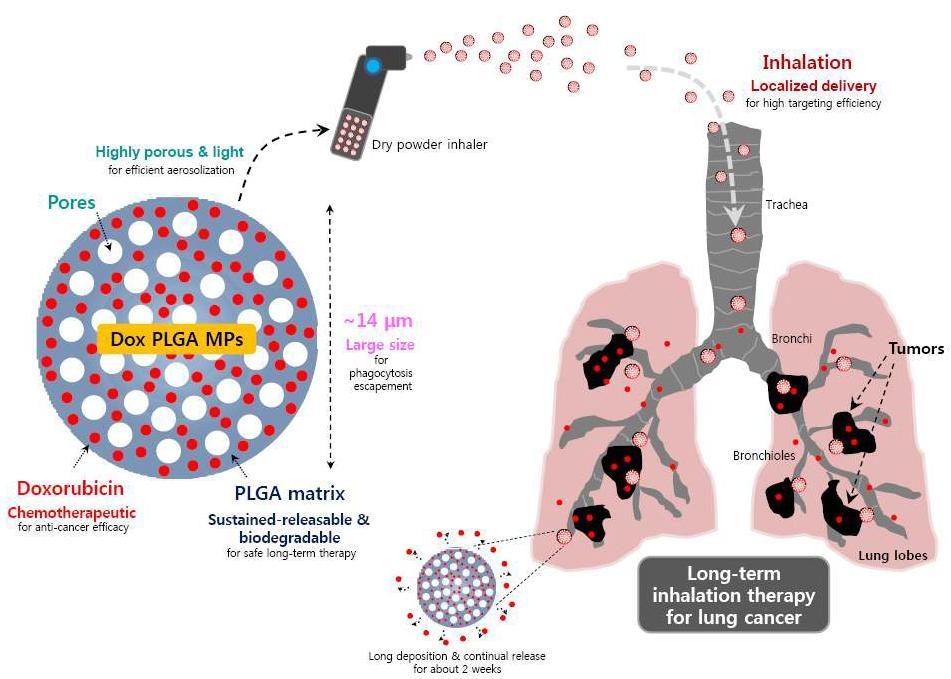 독소루비신 봉입 다공성 마이크로입자의 흡입을 통한 폐암치료의 개요