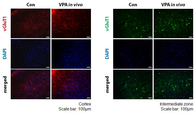 in vivo 발프로산 흰쥐 모델에서 흥분성 신경세포 증가.