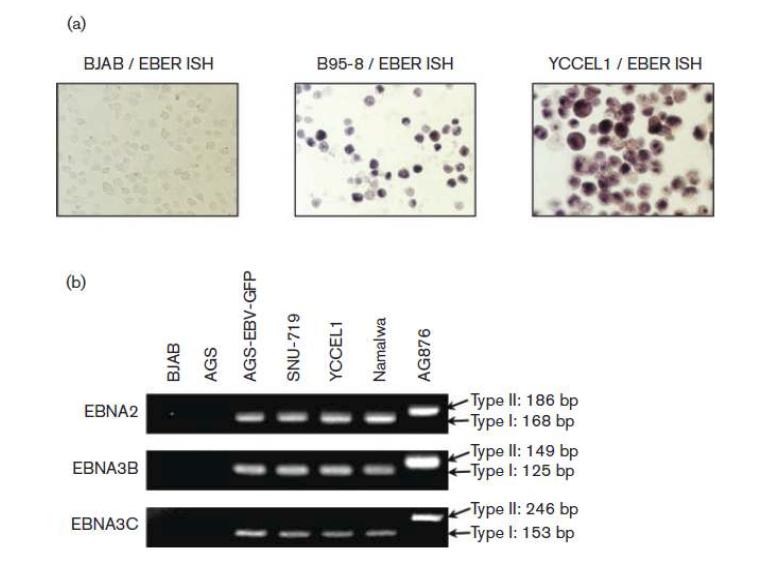 YCCEL1 세포주의 EBV 감염 여부 조사