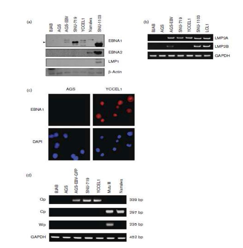 YCCEL1 세포주에서 EBV 잠재 감염 연관 유전자의 발현 양상 확인