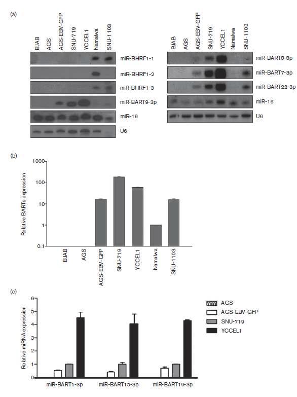 YCCEL1 세포주에서 microRNA 발현 양상 확인