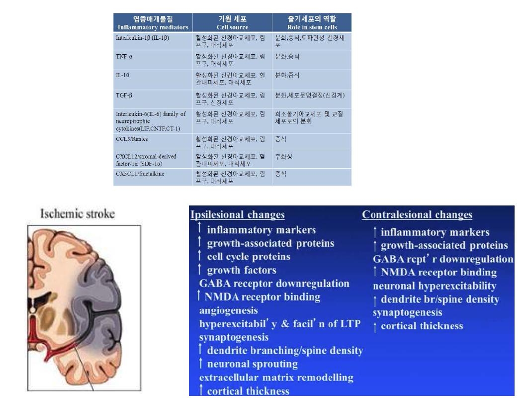 허혈성 뇌졸중 후 뇌조직에서 일어나는 변화