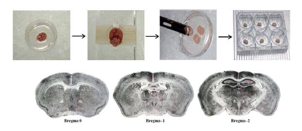 생체외 조직배양 과정과 절단된 뇌의 단면