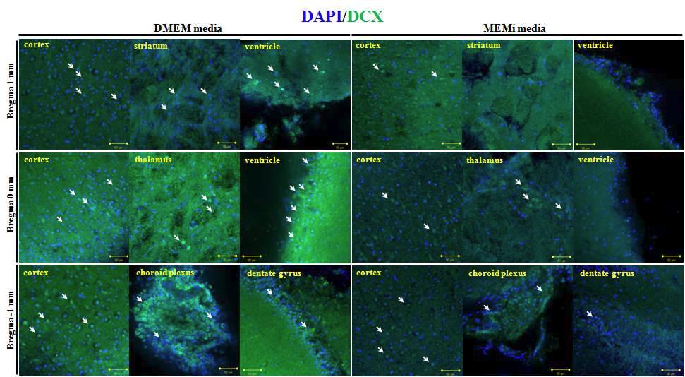 생체외 배양한 정상 뇌조직에서 배지에 따른 doublecortin의 발현 비교