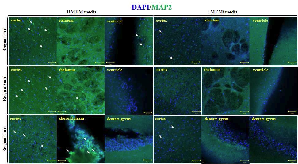 생체외 배양한 정상 뇌조직에서 배지에 따른 MAP2의 발현 비교