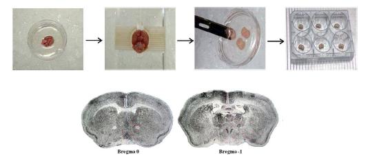 생체 외 조직배양 과정과 절단된 뇌의 단면