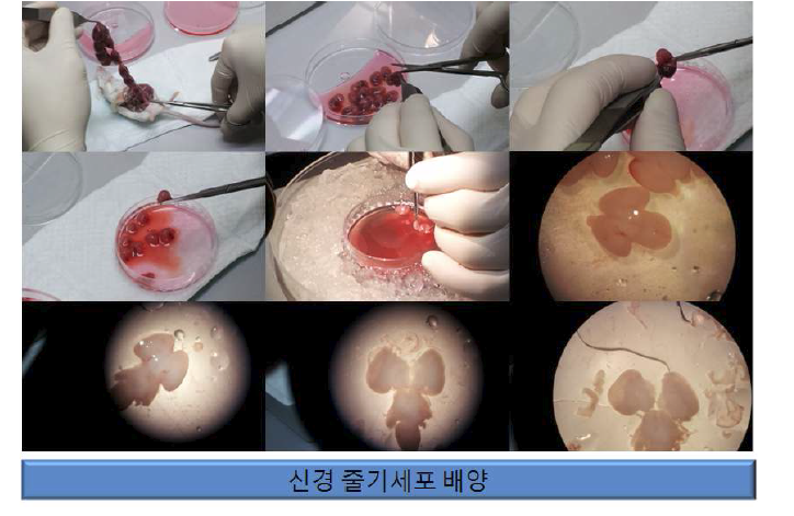 E14 embryo를 이용한 신경줄기세포 배양