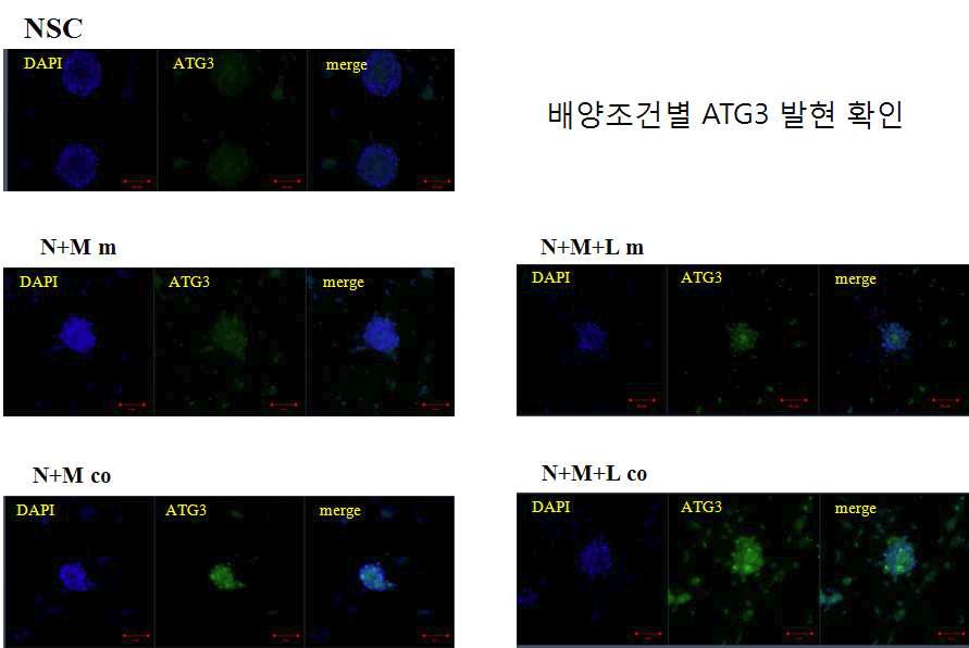 세포배양 조건에 따른 포식작용(phagocytosis) 정도