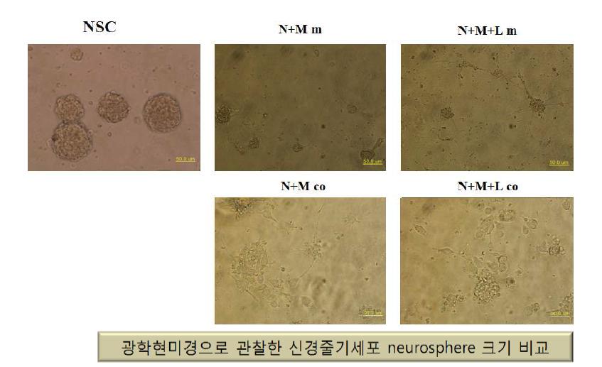 세포배양 조건에 따른 신경줄기세포구의 크기 비교