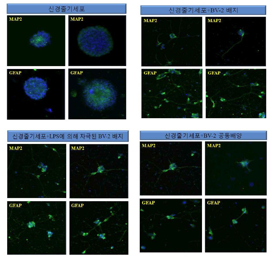 배양조건에 따른 신경줄기세포들의 분화 양상의 변화