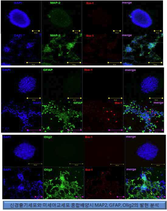 미세아교세포 혼합배양시 신경줄기세포의 분화 양상의 변화