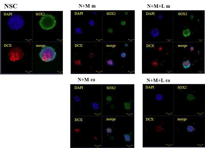 배양조건의 변화에 따른 신경줄기세포의 Sox-2, DCX의 발현 변화