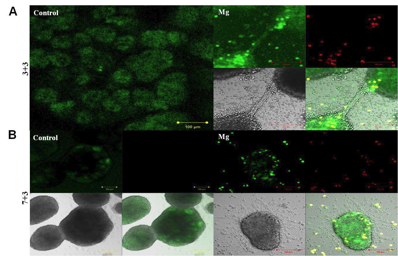 형광표지된 신경줄기세포와 미세아교세포 혼합배양시 형태학적 변화에 대한 live image